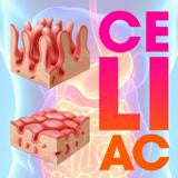 What is Celiac Disease?